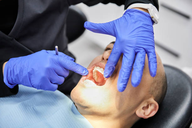 Best Emergency Dental Extractions in Kenhorst, PA